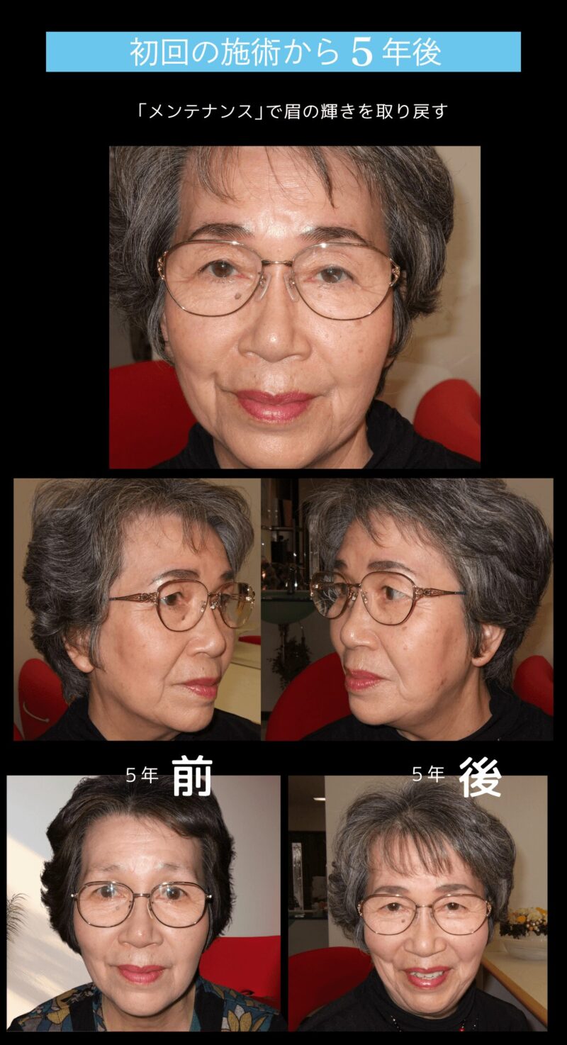 blog施術流れ-3