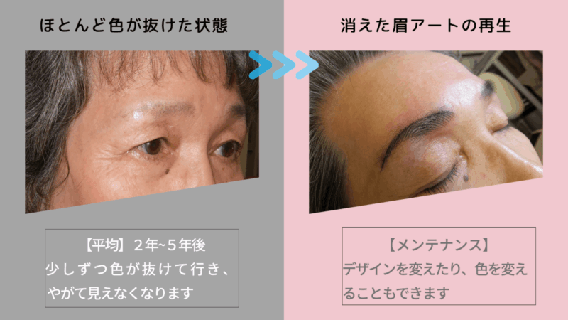 blog施術流れ-4