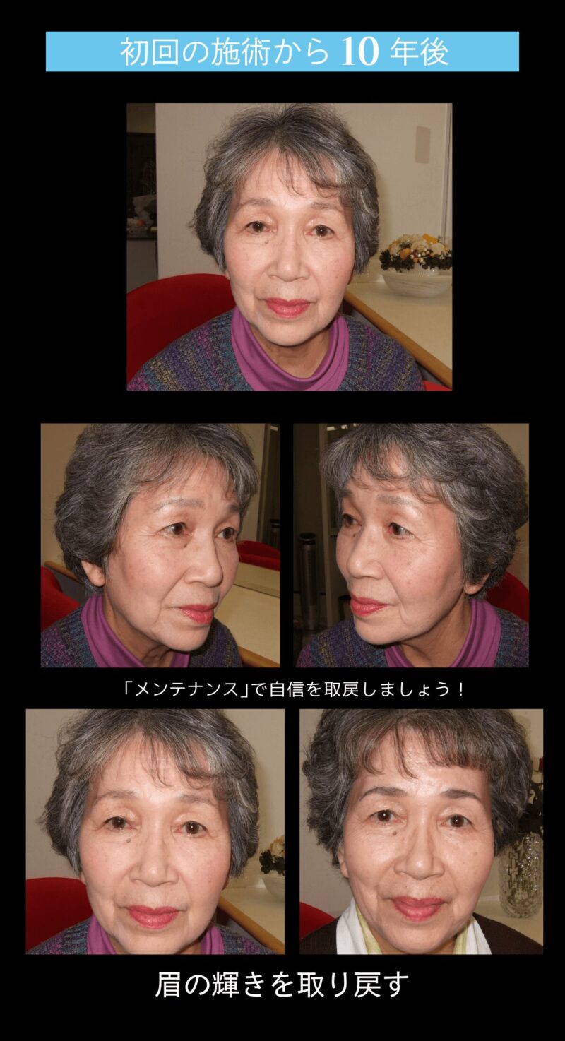 blog施術流れ-5