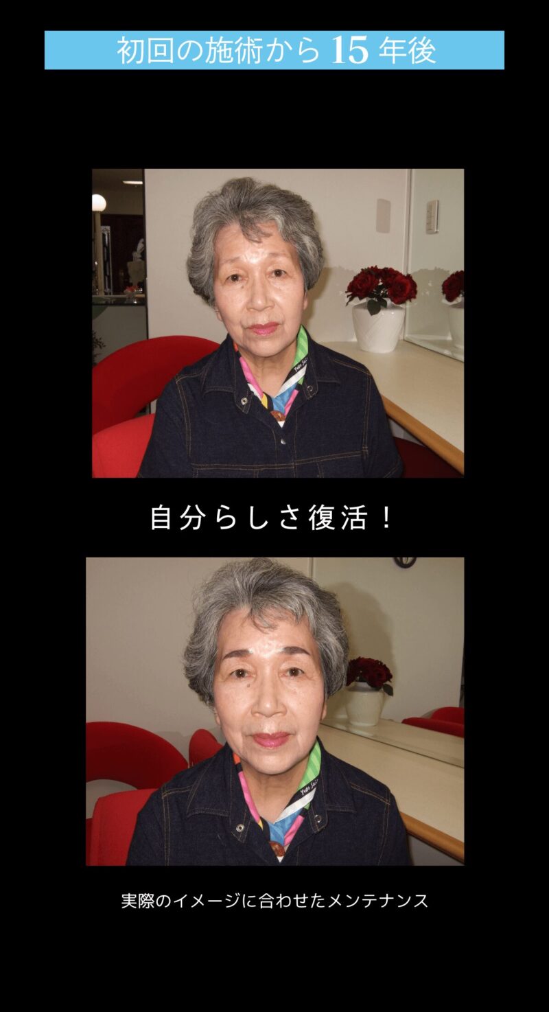 blog施術流れ-7