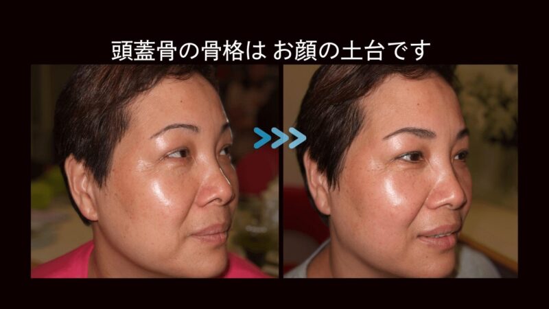 blog2-眉バランス-3