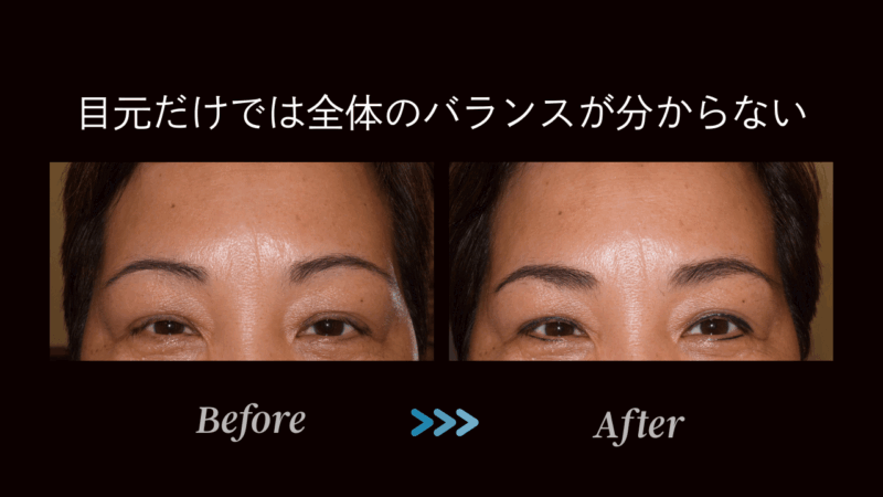 blog2-眉バランス-5